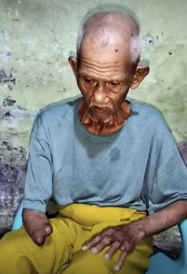 Kisah Pilu Kakek Yatim Asal Medan, Tangan Cacat Tetap Narik Becak Malah Dilarikan Penumpang - NavigasiVisual