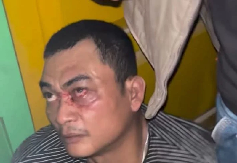Mau Ubah Wajah Jadi Bengkak? Tiru Aja Abang Ini - navigasivisual.id